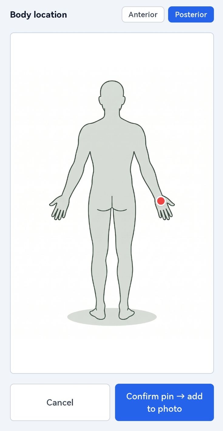 Pinning the location of a lesion on a body map on a phone