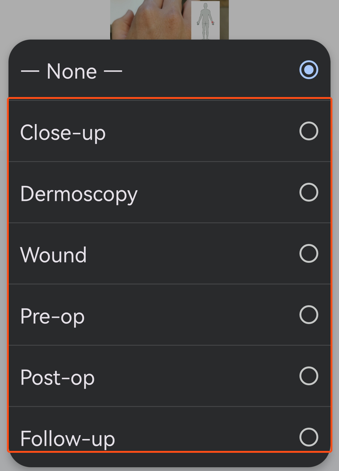 The image type list